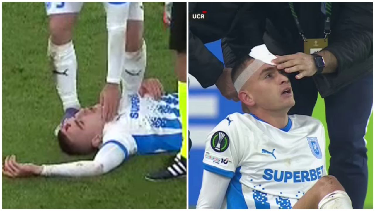 Scene terifiante în Rakow – Craiova! Apărătorul oltenilor s-a prăbușit, acoperit de sânge