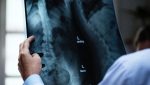 Pneumologul Beatrice Mahler avertizează asupra impactului crește în apariția cancerului pulmonar la nefumători din cauza poluării aeruluiea noastră”