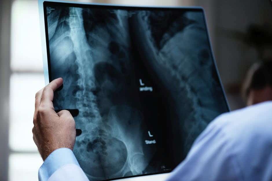 Pneumologul Beatrice Mahler avertizează asupra impactului crește în apariția cancerului pulmonar la nefumători din cauza poluării aeruluiea noastră”