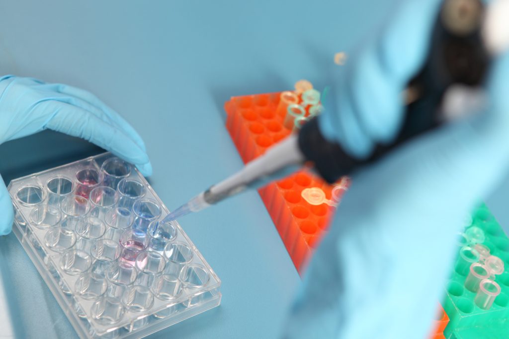 Un donator de spermă cu o mutație genetică severă a devenit tată pentru aproape 200 de copii în Europa, existând riscuri de cancer osos, cerebral sau leucemie în rândul acestora