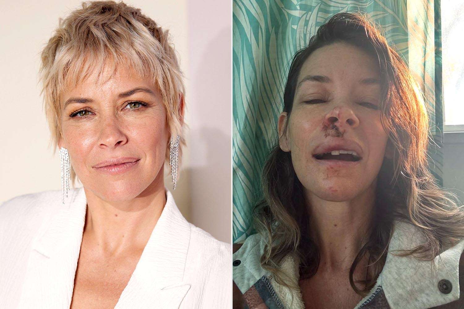 Evangeline Lilly, diagnosticul de leziune cerebrală: „Am fost binecuvântată, dar lupta continuă” Actrița Evangeline Lilly a făcut recent o dezvăluire îngrijorătoare privind starea sa de sănătate