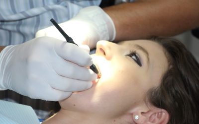 teeth-cleaning-1514692_1280.jpg - JurnalUrban