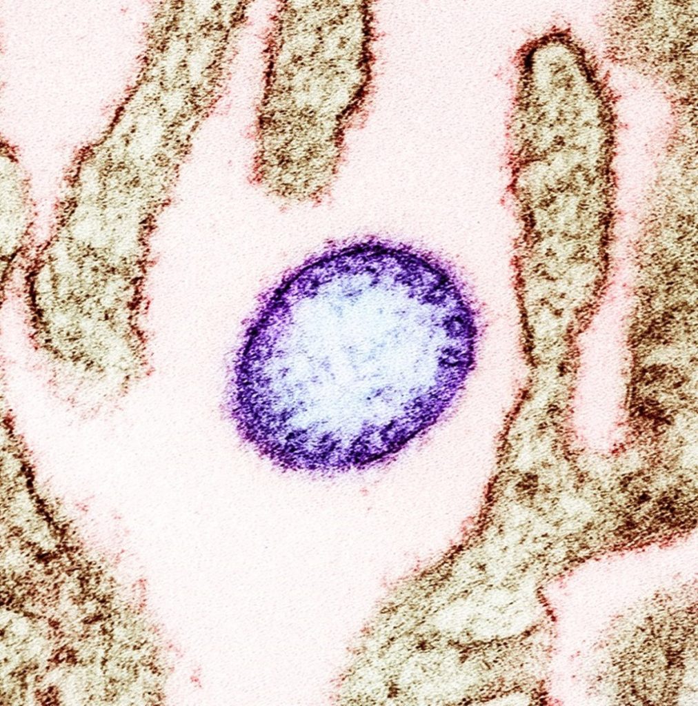 OMS calmează temerile privind riscul de răspândire a virusului Nipah din India După ce în recentul interval au fost raportate două cazuri de infectare cu virusul Nipah în India, Organizația Mondială a Sănătății (OMS) a emis un comunicat oficial în care își exprimă încrederea că implicitul pericol de răspândire a virusului în afara granițelor indiene este redus semnificativ
