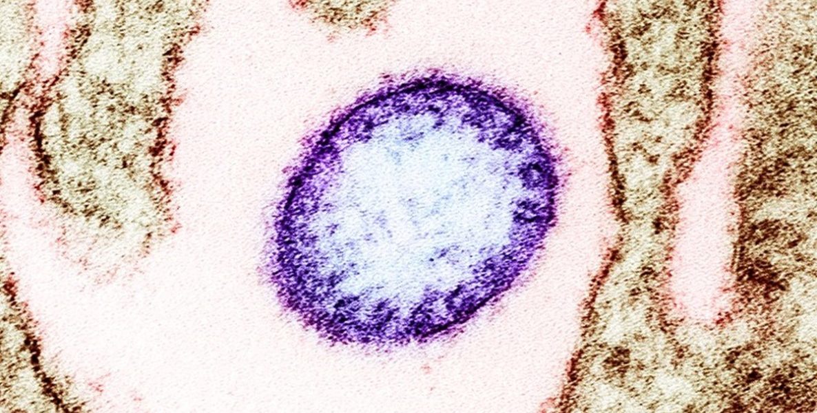 virus-Nipah.jpg - JurnalUrban