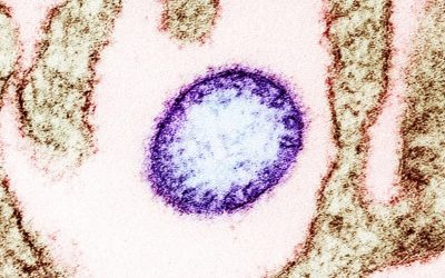 virus-Nipah.jpg - JurnalUrban