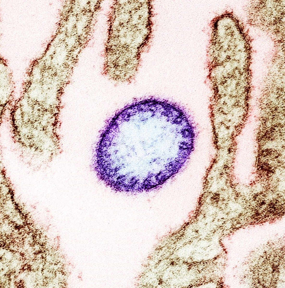 OMS calmează temerile privind riscul de răspândire a virusului Nipah din India După ce în recentul interval au fost raportate două cazuri de infectare cu virusul Nipah în India, Organizația Mondială a Sănătății (OMS) a emis un comunicat oficial în care își exprimă încrederea că implicitul pericol de răspândire a virusului în afara granițelor indiene este redus semnificativ