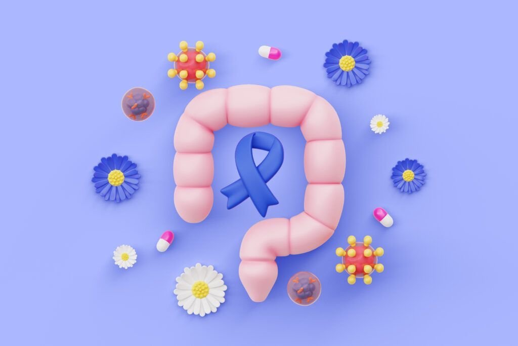 Leguma banală reduce riscul de cancer de colon cu 20%
