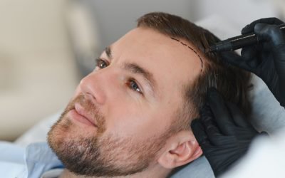 Foliculi-de-par-complet-functionali_shutterstock_Descopera-10.jpg - JurnalUrban