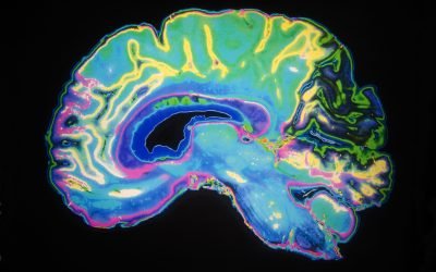 alzheimer-dementa-shutter_Descopera-scaled.jpg - JurnalUrban