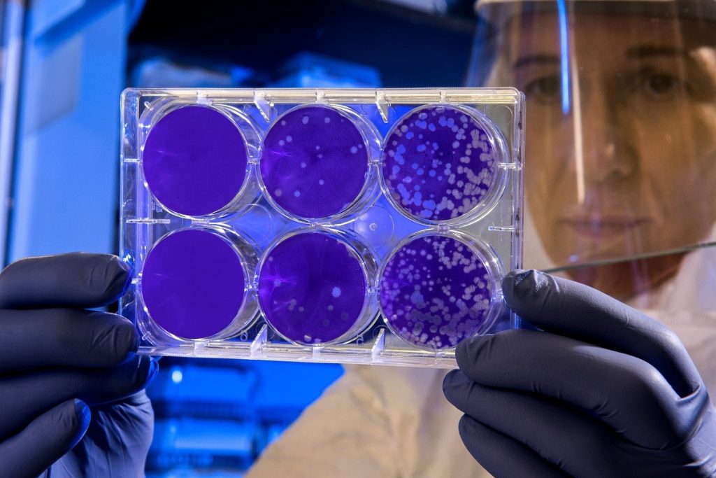 Bacterie din intestin, descoperire importantă pentru forța musculară Oamenii de știință au identificat o bacterie prezentă în intestinul uman care ar putea juca un rol crucial în menținerea forței musculare, o descoperire ce deschide calea către dezvoltarea unor probiotice menite să amelioreze performanța fizică și să prevină declinul muscular asociat cu înaintarea în vârstă
