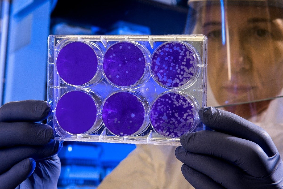 Bacterie din intestin, descoperire importantă pentru forța musculară Oamenii de știință au identificat o bacterie prezentă în intestinul uman care ar putea juca un rol crucial în menținerea forței musculare, o descoperire ce deschide calea către dezvoltarea unor probiotice menite să amelioreze performanța fizică și să prevină declinul muscular asociat cu înaintarea în vârstă