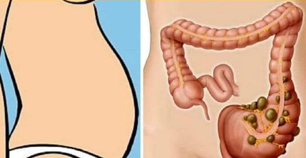 Deficit de vitamine: 4 cauze ascunse ale constipației
