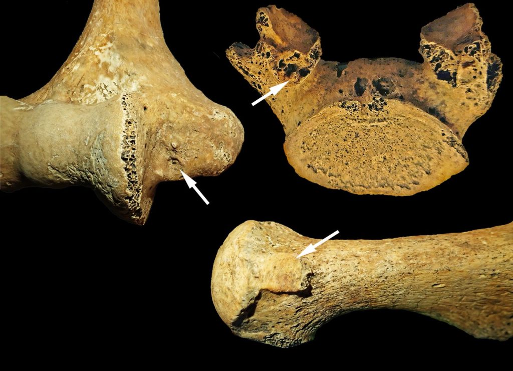 O femeie din Epoca de Piatră îngropată ca un bărbat: noi perspective asupra rolurilor de gen în preistorie Un studiu recent, publicat în American Journal of Biological Anthropology, aruncă o nouă lumină asupra complexității rolurilor de gen în urmă cu 7.000 de ani, în Europa