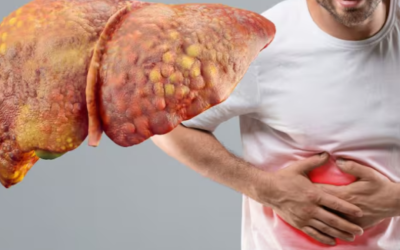 ficat-gras-1024x575.png - JurnalUrban