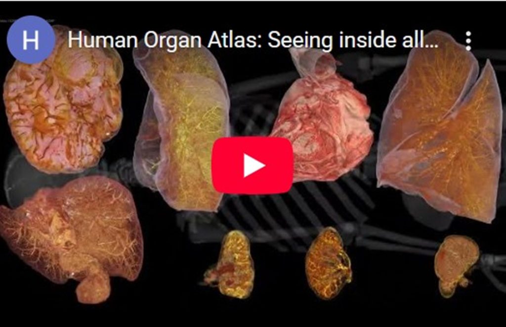 Un atlas digital al corpului uman, accesibil online, revoluționează studiul anatomiei Un consorțiu internațional de cercetători a lansat un atlas digital interactiv al organelor umane, o premieră care oferă acces gratuit la imagini detaliate, de înaltă rezoluție, ale structurii interne a corpului