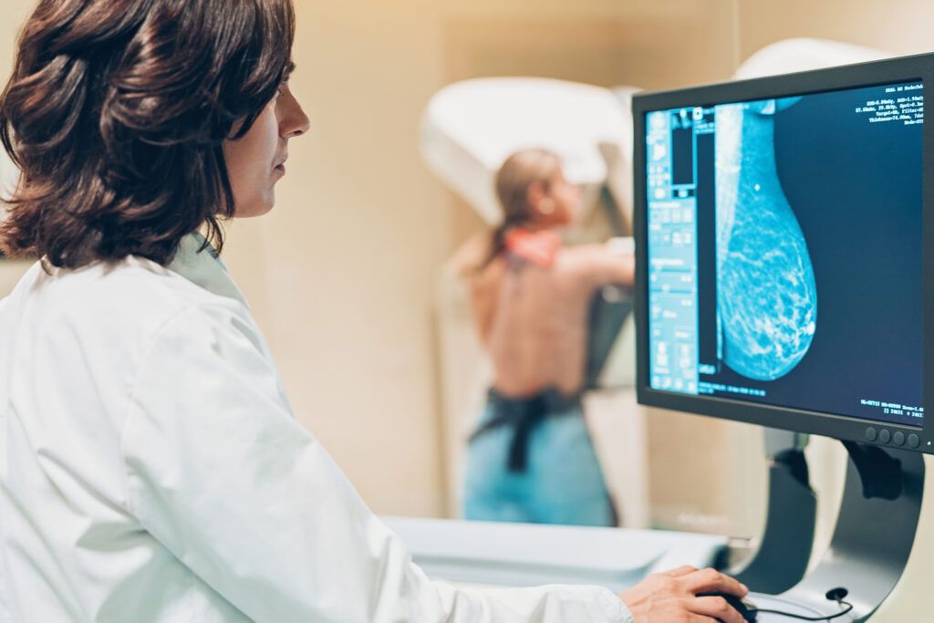 Depistarea precoce, crucială în lupta cu cancerul de sân: Peste 12.000 de românce, diagnosticate anual Anual, în România, peste 12.000 de femei sunt diagnosticate cu cancer de sân