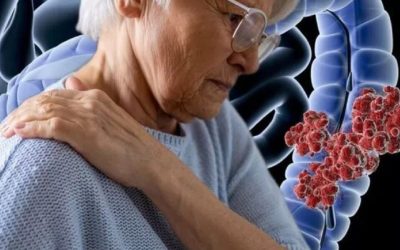 oboseala-de-la-cancer-1024x598.jpg - JurnalUrban