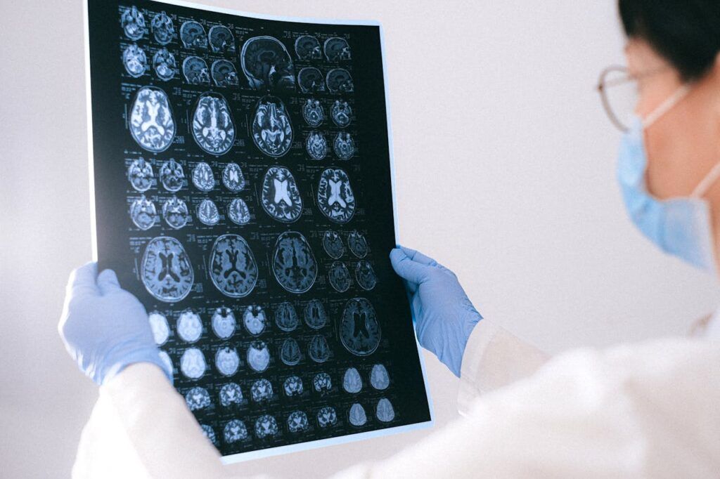 Indicii clare ale unei tumori cerebrale: Nu ignora semnele!