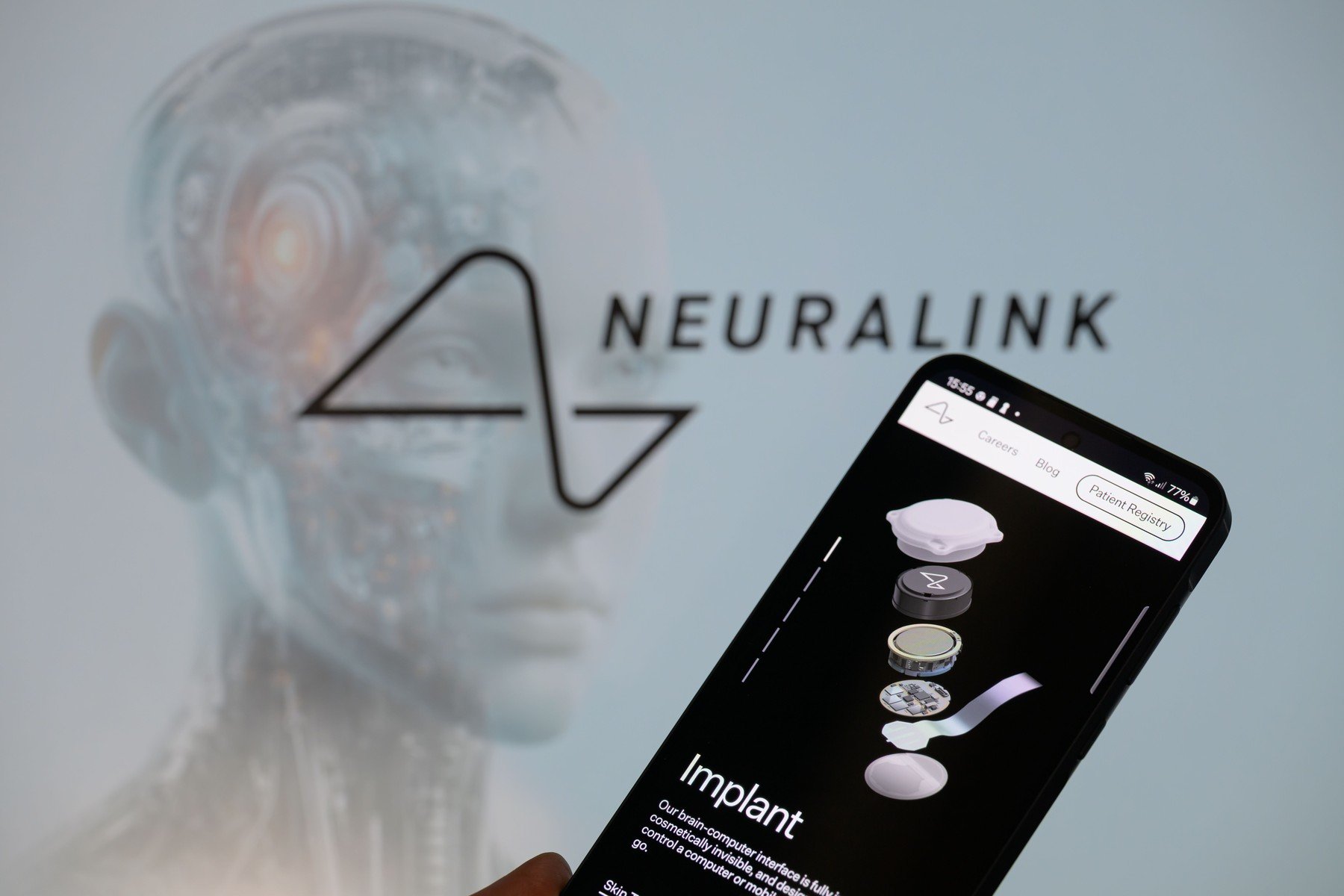 China avansează în domeniul interfețelor creier-computer: primul implant aprobat pentru comercializare Autoritățile chineze au aprobat comercializarea primului implant cerebral dezvoltat de o companie locală, un pas important în dezvoltarea interfețelor creier-computer