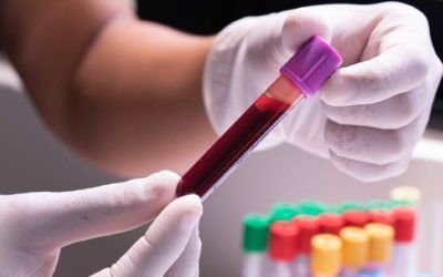 test-de-sange-1024x455.jpg - JurnalUrban