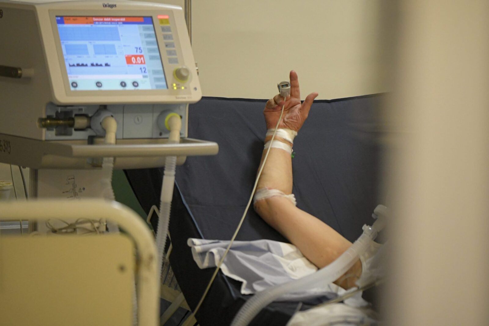 Mutație rară: Pacient HIV vindecat complet după transplant
