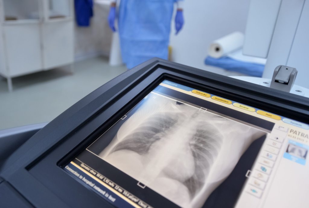 Medic român, descoperire ULUITOARE în corpul unei femei: „Am înghețat”