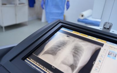 Medic român, descoperire ULUITOARE în corpul unei femei: „Am înghețat”
