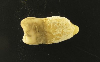 Scarlatină precolumbiană: Bacteria ucigașă, găsită într-o mumie