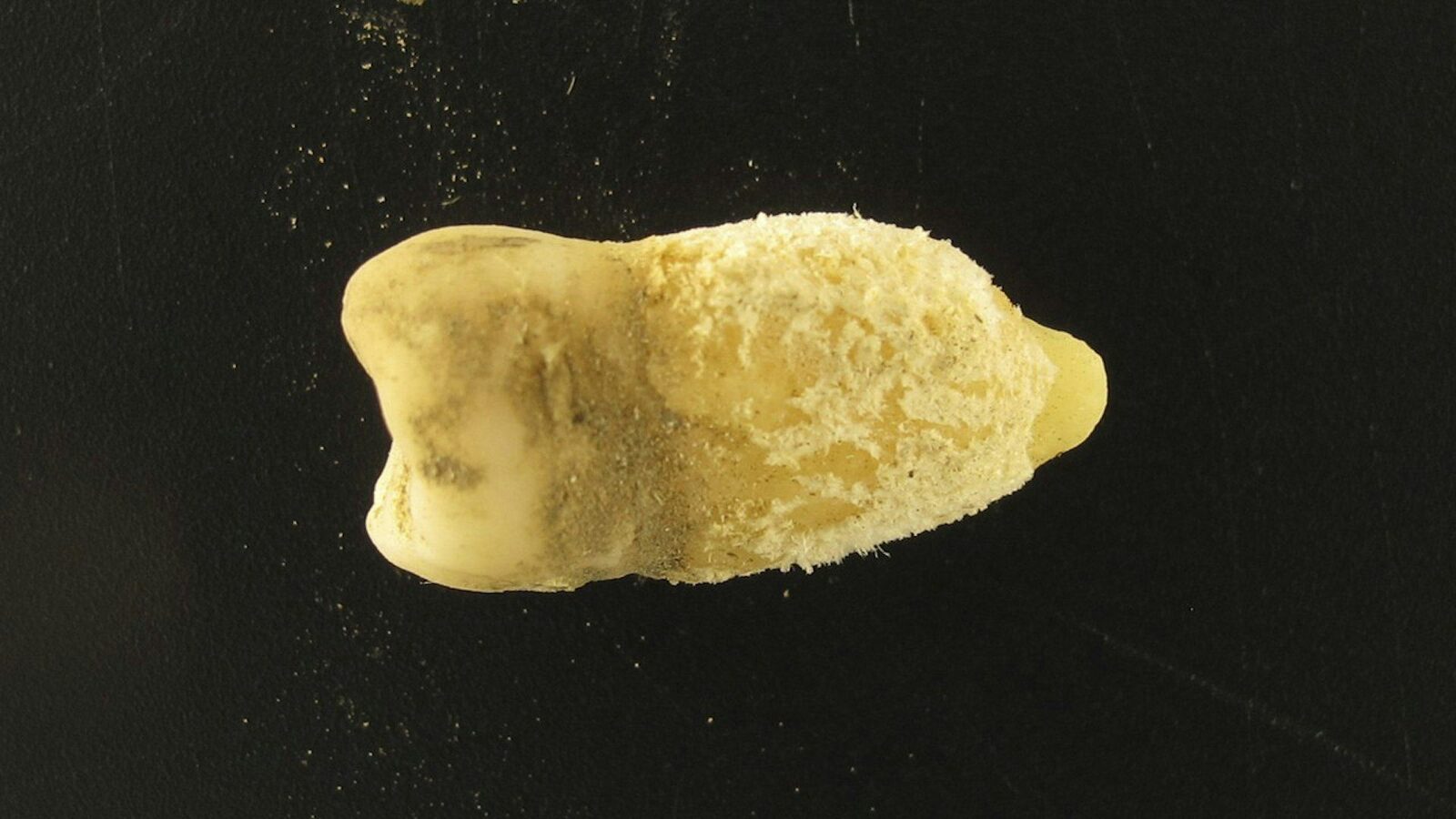 Scarlatină precolumbiană: Bacteria ucigașă, găsită într-o mumie