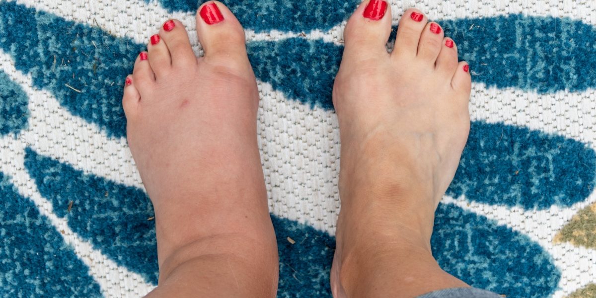 Semnele-ascunse-de-pe-picioare-care-pot-indica-probleme-grave-de-sanatate.-La-ce-trebuie-sa-fii-aten.jpeg - JurnalUrban