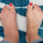 Semnele-ascunse-de-pe-picioare-care-pot-indica-probleme-grave-de-sanatate.-La-ce-trebuie-sa-fii-aten.jpeg - JurnalUrban