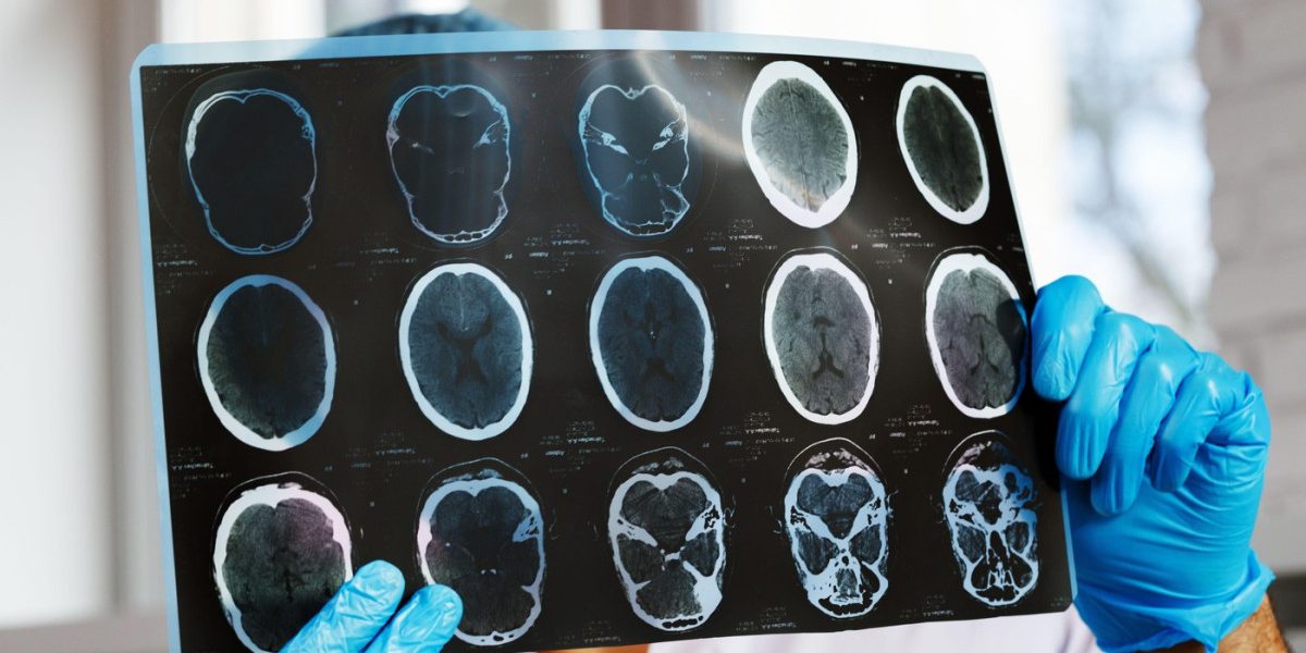 aGFzaD0wMWY1YzUxNWQ0NjdjNjZhMzc4YzgzYmRlODU5MzlhZQ.thumb_.jpg - JurnalUrban