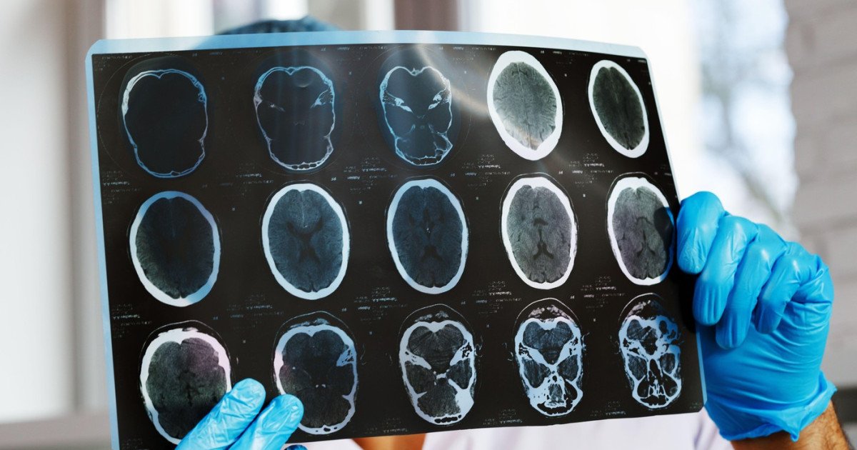 Asociațiile de pacienți cer ajutor: Investigațiile medicale, prăbușite cu 47%