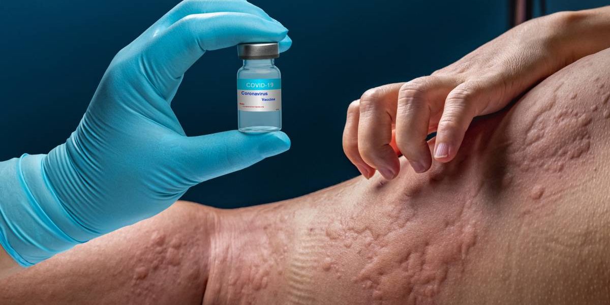 alergii.jpg - JurnalUrban