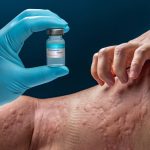 alergii.jpg - JurnalUrban