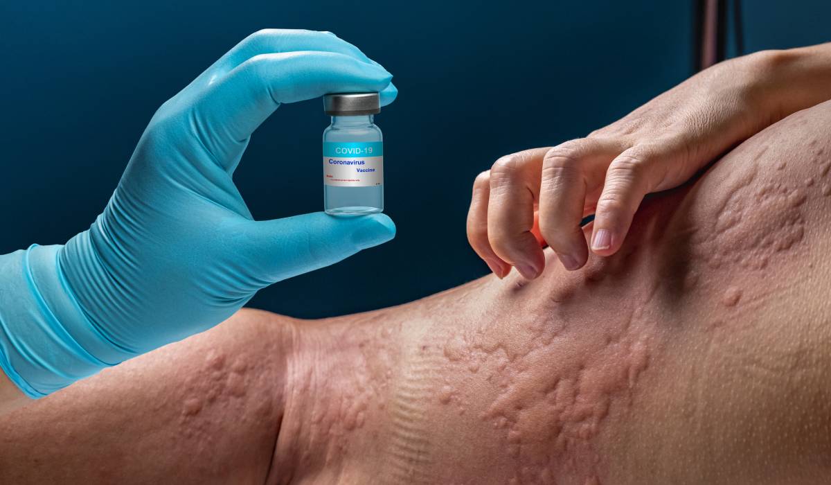Tânăra cu 40 de alergii, miracol după tratament anti-astm: „Mănânc măr după 10 ani”
