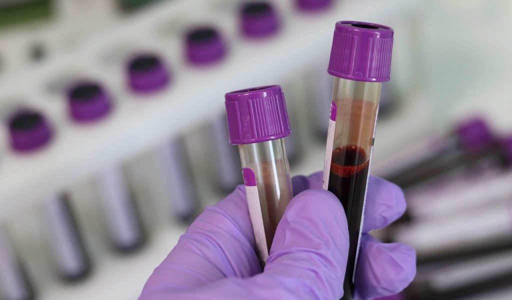 Analiză de sânge revoluționară: Depistează cancerul, chiar fără simptome