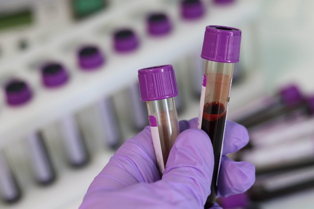 Un simplu test de sânge ar putea revoluționa depistarea cancerului și a altor boli, permițând identificarea semnalelor provenite din diferite organe