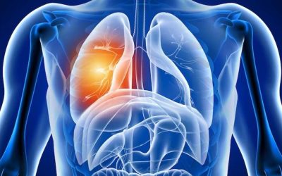 Anchetă cutremurătoare: Ce rămâne în plămâni după COVID-19?