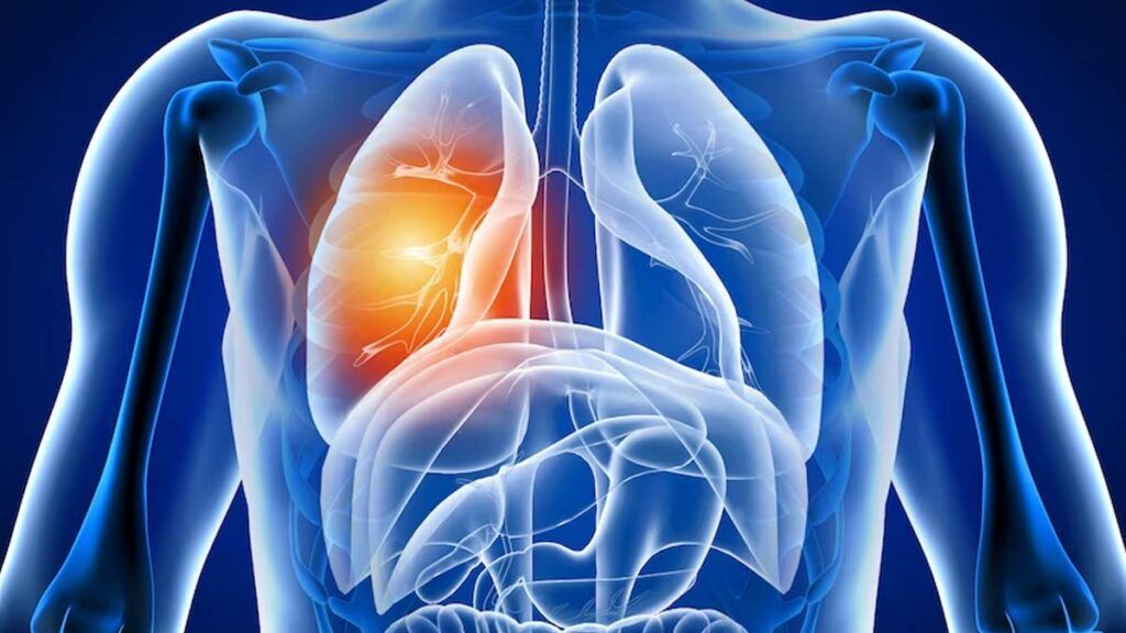 Anchetă cutremurătoare: Ce rămâne în plămâni după COVID-19?