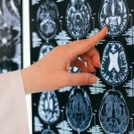 creier-radiografie-tesut-cerebral-rmn-tomograf-e1701797034546.jpg - JurnalUrban