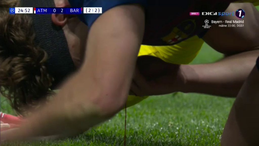 Fermo Lopez, măcel în careul lui Atletico: Sânge șiroaie după un duel