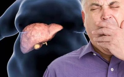 Boala ficatului gras, tratată fără dietă. Descoperirea șoc a cercetătorilor din România