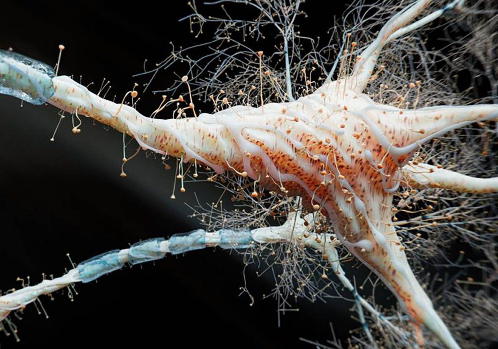 Cercetătorii au descoperit o legătură surprinzătoare între inflamația intestinală și scleroza multiplă (SM), o boală autoimună gravă care afectează sistemul nervos central