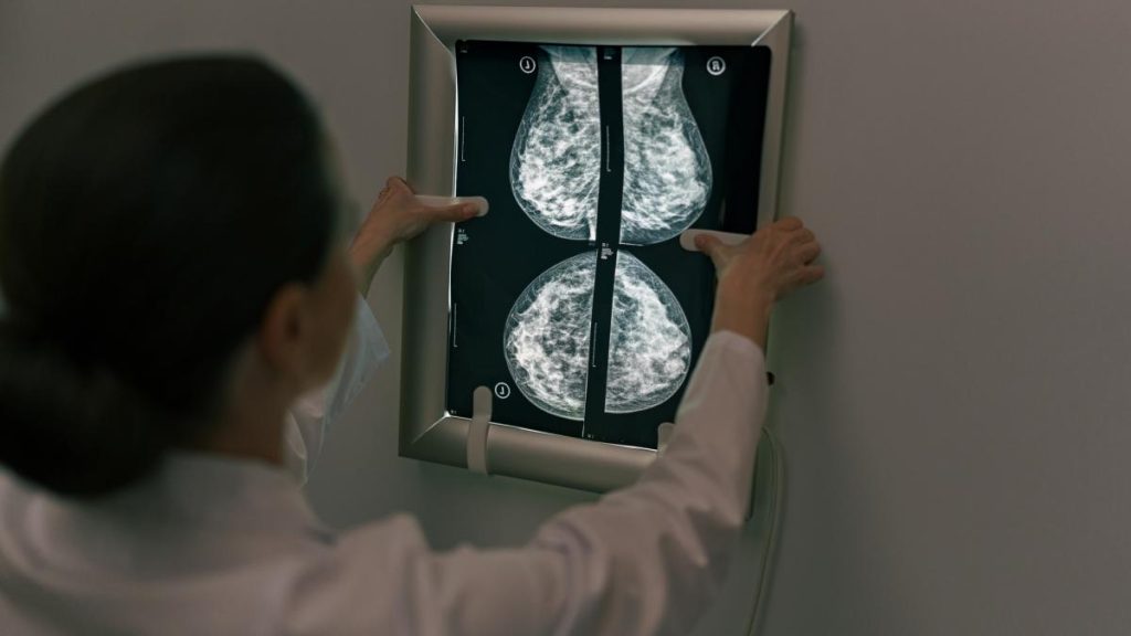 Depistarea precoce a cancerului de sân, crucială pentru supraviețuire, este facilitată de investigații simple precum ecografia și mamografia