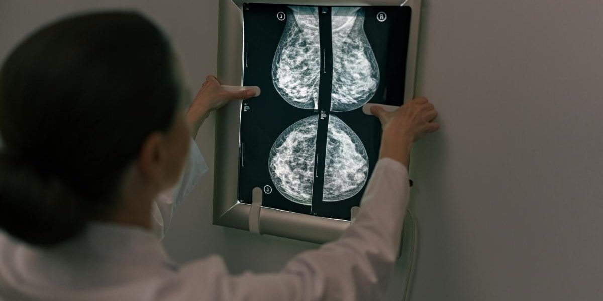 la-ce-varsta-trebuie-sa-incepi-controalele-pentru-depistarea-cancerului-de-san-se-face-chiar-daca-nu.webp - JurnalUrban