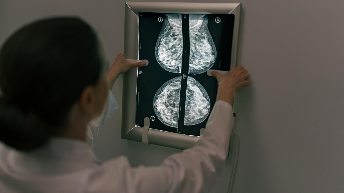 Depistarea precoce a cancerului de sân, crucială pentru supraviețuire, este facilitată de investigații simple precum ecografia și mamografia
