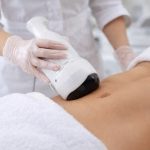 liposuctia.jpeg - JurnalUrban