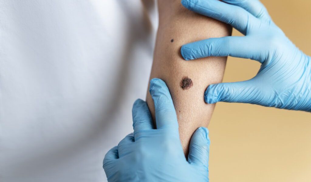 O aluniță fatală: O femeie a murit după o intervenție, detaliile șochează