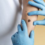 O aluniță fatală: O femeie a murit după o intervenție, detaliile șochează